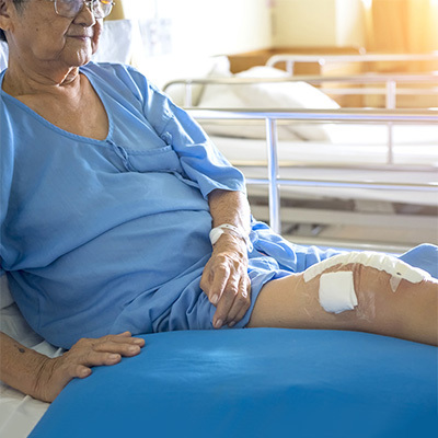 A woman lying in bed with wounds bandaged on her leg and arm.