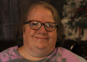 patient smiling with reindeer antlers on